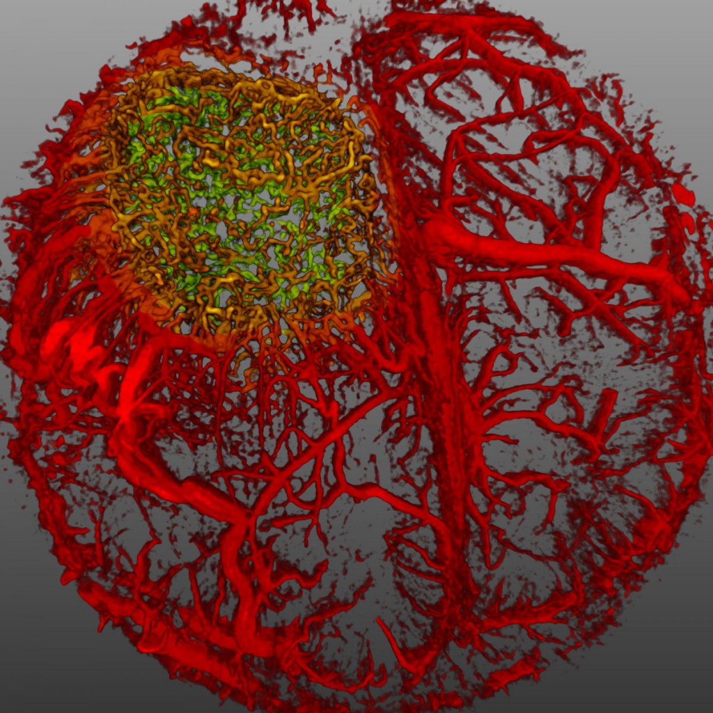 Mạch máu của một con chuột còn sống (màu đỏ) với những khối mô u nguyên bào đệm (màu vàng và xanh lá)